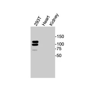 Western blot showing specific bands in HEK293T cell lysate, mouse heart, and kidney for CD140a antibody