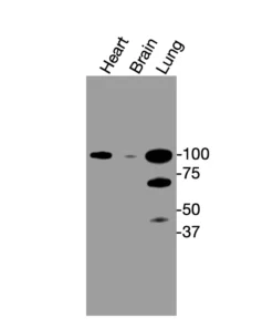 Western blot showing specific bands in mouse heart, brain, and lung for Catenin α1 antibody