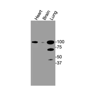 Western blot showing specific bands in mouse heart, brain, and lung for Catenin α1 antibody