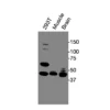 Western blot showing specific bands in HEK293 cell lysate, mouse muscle, and mouse brain for DAG1 antibody