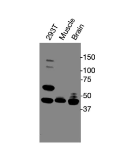 Western blot showing specific bands in HEK293 cell lysate, mouse muscle, and mouse brain for DAG1 antibody