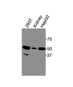 Western blot showing specific bands in HEK293T cell lysate, mouse kidney, and HepG2 cell lysate for ERRα antibody