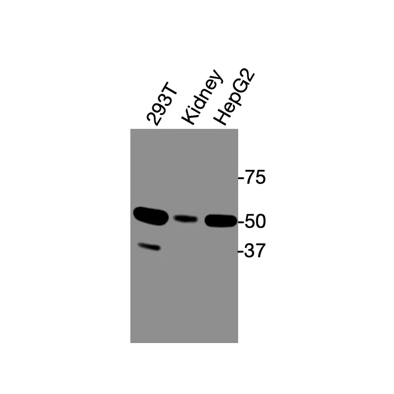 Western blot showing specific bands in HEK293T cell lysate, mouse kidney, and HepG2 cell lysate for ERRα antibody