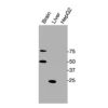 Western blot showing specific bands in mouse brain, mouse liver, and HepG2 cell lysate for GR antibody