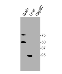 Western blot showing specific bands in mouse brain, mouse liver, and HepG2 cell lysate for GR antibody