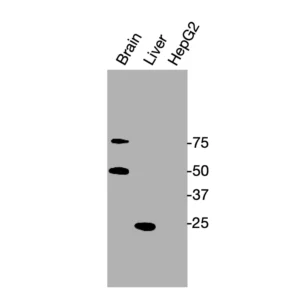 Western blot showing specific bands in mouse brain, mouse liver, and HepG2 cell lysate for GR antibody