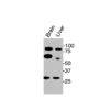 Western blot showing specific bands in mouse brain, and mouse liver for Merlin antibody (NF2 antibody)