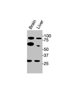 Western blot showing specific bands in mouse brain, and mouse liver for Merlin antibody (NF2 antibody)