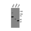 Western blot showing specific bands in HEK293T cell lysate, mouse eWAT, and liver for PPARγ antibody