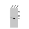 Western blot showing specific bands in HEK293T, HeLa cell lysates, and mouse heart for RARγ antibody