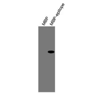 Alternative view of Anti-mouse/human RARγ Recombinant Monoclonal Antibody (XM0044)