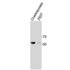 Western blot showing specific bands in overexpress sample and HEK293T cell lysate for RORγ