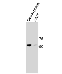 Western blot showing specific bands in overexpress sample and HEK293T cell lysate for RORγ