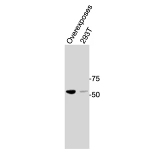 Western blot showing specific bands in overexpress sample and HEK293T cell lysate for RORγ