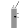Western blot showing specific bands in HEK293T cell lysate, over-expressed human RXRα sample for RXRα antibody