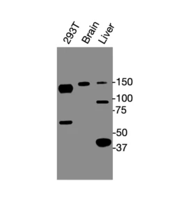 Western blot showing specific bands in HEK293 cell lysate, mouse brain, and mouse liver for SAV1 antibody