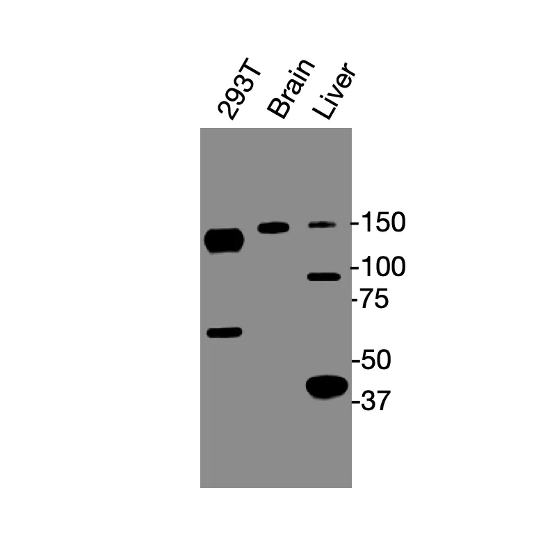 Western blot showing specific bands in HEK293 cell lysate, mouse brain, and mouse liver for SAV1 antibody