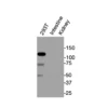 Western blot showing specific bands in HEK293T cell lysate, mouse intestine, and mouse kidney for VDR