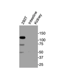 Western blot showing specific bands in HEK293T cell lysate, mouse intestine, and mouse kidney for VDR