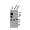 Western blot showing specific bands in HEK293T cell lysate, mouse intestine, and mouse kidney for VDR