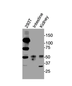 Western blot showing specific bands in HEK293T cell lysate, mouse intestine, and mouse kidney for VDR
