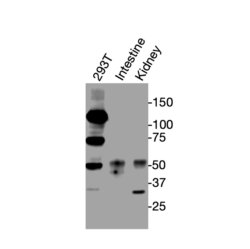 Western blot showing specific bands in HEK293T cell lysate, mouse intestine, and mouse kidney for VDR