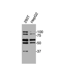 Western blot showing specific bands in HEK293 and HepG2 cell lysates for TJP2 antibody (ZO-2 antibody)