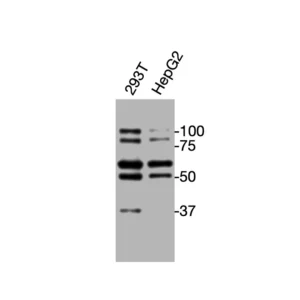 Western blot showing specific bands in HEK293 and HepG2 cell lysates for TJP2 antibody (ZO-2 antibody)