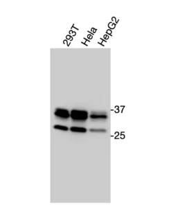 Western blot showing specific bands in HEK293T, HeLa, and HepG2 cell lysates for CCR10 antibody
