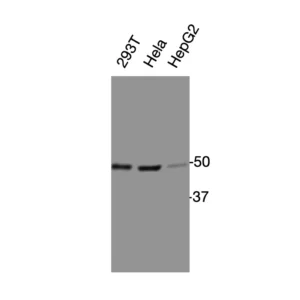 Western blot showing specific bands in HEK293T, HeLa, and HepG2 cell lysates for CMKLR1 antibody (ChemR23 antibody)