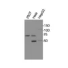 Western blot showing specific bands in HEK293T, HeLa, and HepG2 cell lysates for CXCR4 antibody