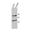Western blot showing specific bands in HEK293T and HepG2 cell lysates for EDNRB antibody
