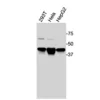 Western blot showing specific bands in HEK293T, HeLa, and HepG2 cell lysates for human LXRα antibody.