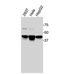 Western blot showing specific bands in HEK293T, HeLa, and HepG2 cell lysates for human LXRα antibody.