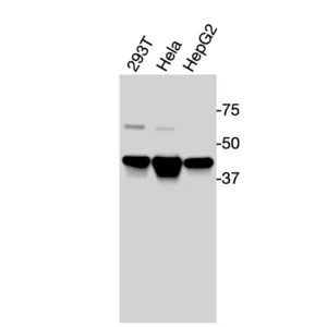 Western blot showing specific bands in HEK293T, HeLa, and HepG2 cell lysates for human LXRα antibody.