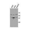 Western blot showing specific bands in HEK293, HeLa, and HepG2 cell lysates for hNPFF2 antibody (GPR74 antibody)