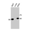 Western blot showing specific bands in HEK293T cell lysate, mouse lung, and mouse brain for CAR antibody