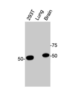 Western blot showing specific bands in HEK293T cell lysate, mouse lung, and mouse brain for CAR antibody