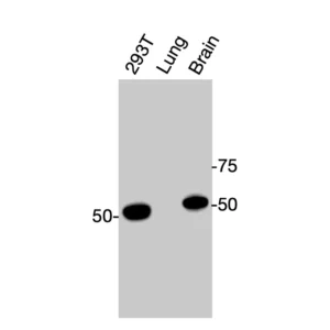 Western blot showing specific bands in HEK293T cell lysate, mouse lung, and mouse brain for CAR antibody