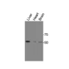 Western blot showing specific bands in mouse liver, mouse heart, and mouse brain for PPARδ antibody