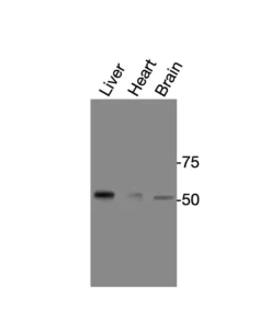 Western blot showing specific bands in mouse liver, mouse heart, and mouse brain for PPARδ antibody
