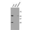 Western blot detection of endogenous mouse GPR20 in brain, liver, and intestine tissue lysates.