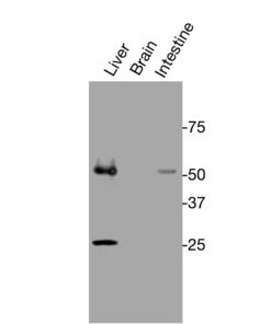 Western blot detection of endogenous mouse GPR20 in brain, liver, and intestine tissue lysates.
