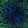 Immunofluorescence staining of mouse lung showing Notch1 (green) and DAPI nuclear counterstain (blue)