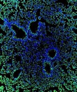 Immunofluorescence staining of mouse lung showing Notch1 (green) and DAPI nuclear counterstain (blue)