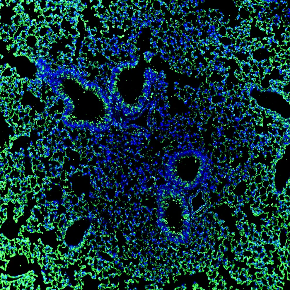 Immunofluorescence staining of mouse lung showing Notch1 (green) and DAPI nuclear counterstain (blue)