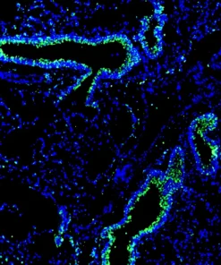 Immunofluorescence staining of mouse lung tissue using Anti-mouse/human PNR Recombinant Monoclonal Antibody (XM0028). PNR is shown in green and nuclei are counterstained with DAPI (blue).