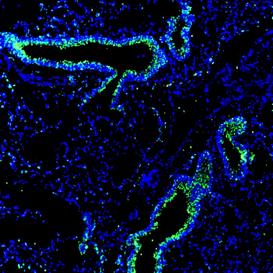 Immunofluorescence staining of mouse lung tissue using Anti-mouse/human PNR Recombinant Monoclonal Antibody (XM0028). PNR is shown in green and nuclei are counterstained with DAPI (blue).