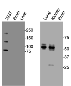 Western blot detection of endogenous Notch1 protein in HEK293T and mouse tissues using Anti-mouse/human Notch1 Recombinant Monoclonal Antibody (XM0053).