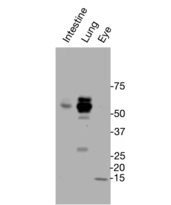 Western blot detection of endogenous PNR protein in mouse intestine, lung, and eye tissues using Anti-mouse/human PNR Recombinant Monoclonal Antibody (XM0028).